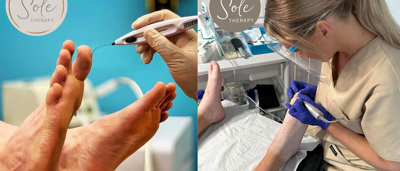 Working with Sole Therapy