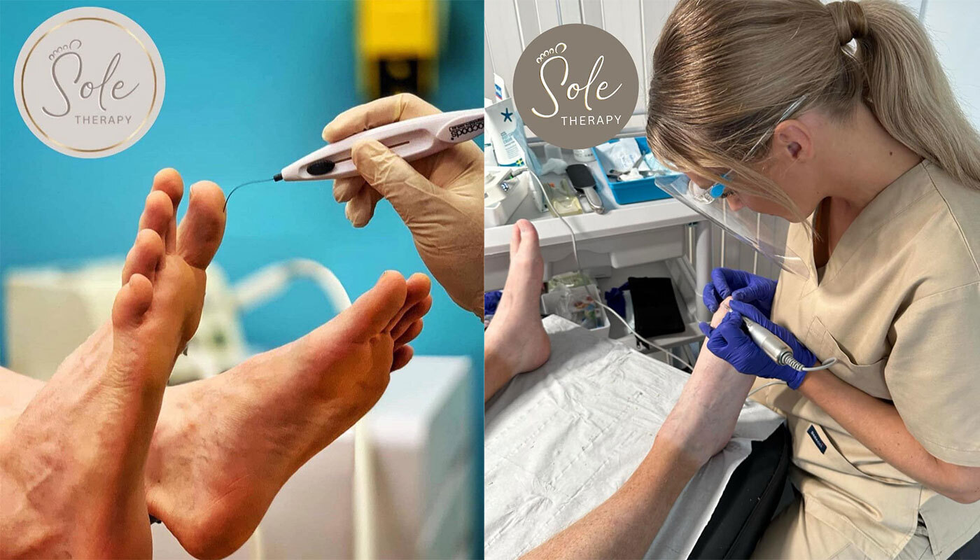 Working with Sole Therapy Working with Sole Therapy